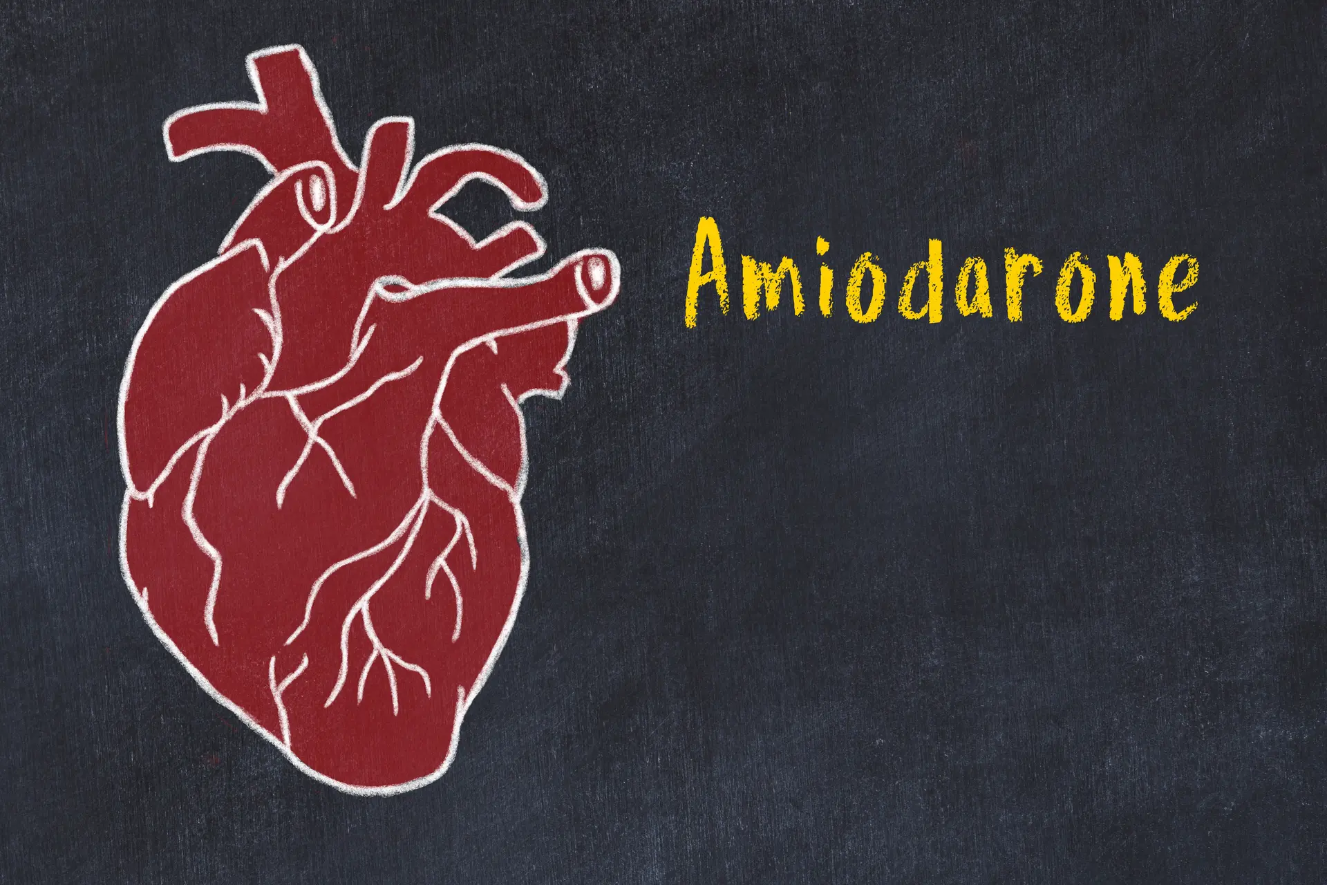 heart Amiodarone