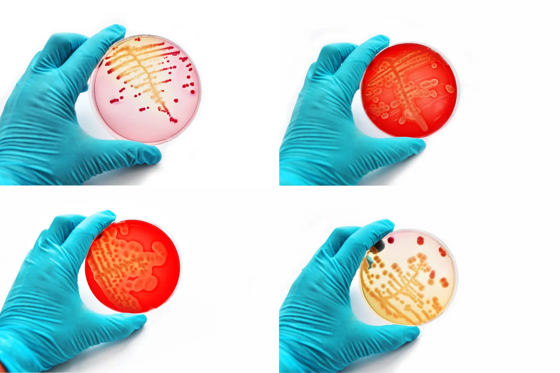 Petri dishes and cultures